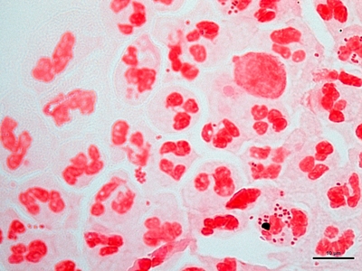 Neisseria gonorrhoeae 02