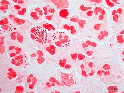 Neisseria gonorrhoeae 03