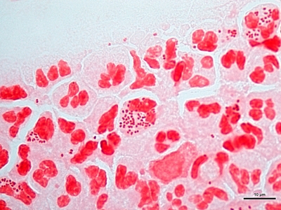 Neisseria gonorrhoeae 04