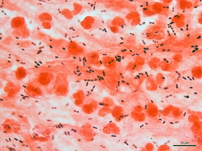 Streptococcus pneumoniae 01