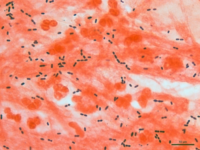 Streptococcus pneumoniae 02