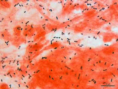 Streptococcus pneumoniae 03